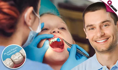 Dental Services: Fluoride Application OR Pit & Fissure Treatment!